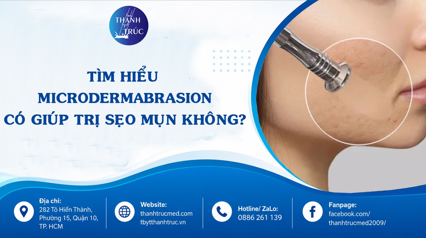 Tìm hiểu Microdermabrasion có giúp trị sẹo mụn không?